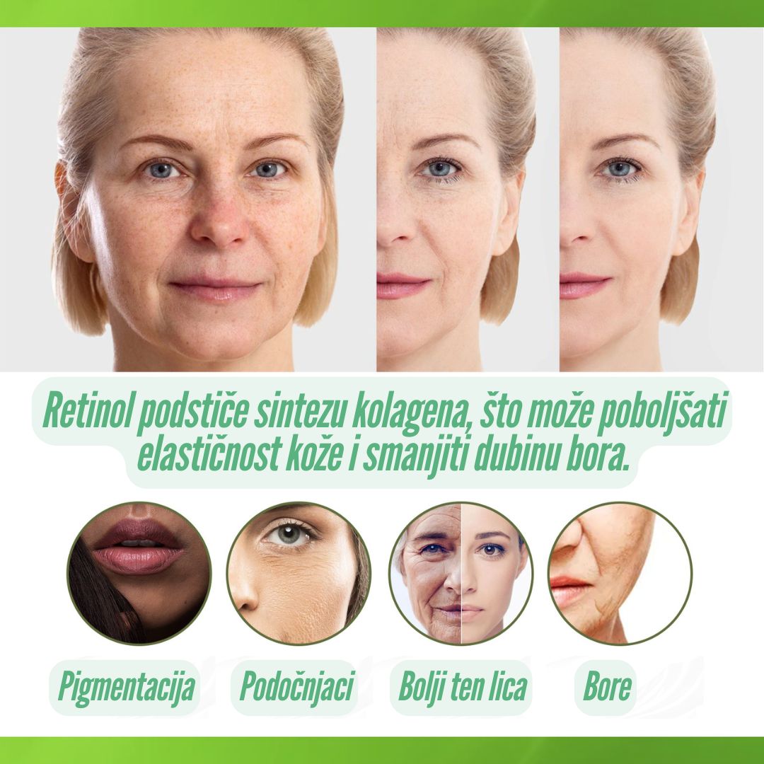 RETINOL 2.5% Serum – Za Glađu Kožu i Ujednačen Ten