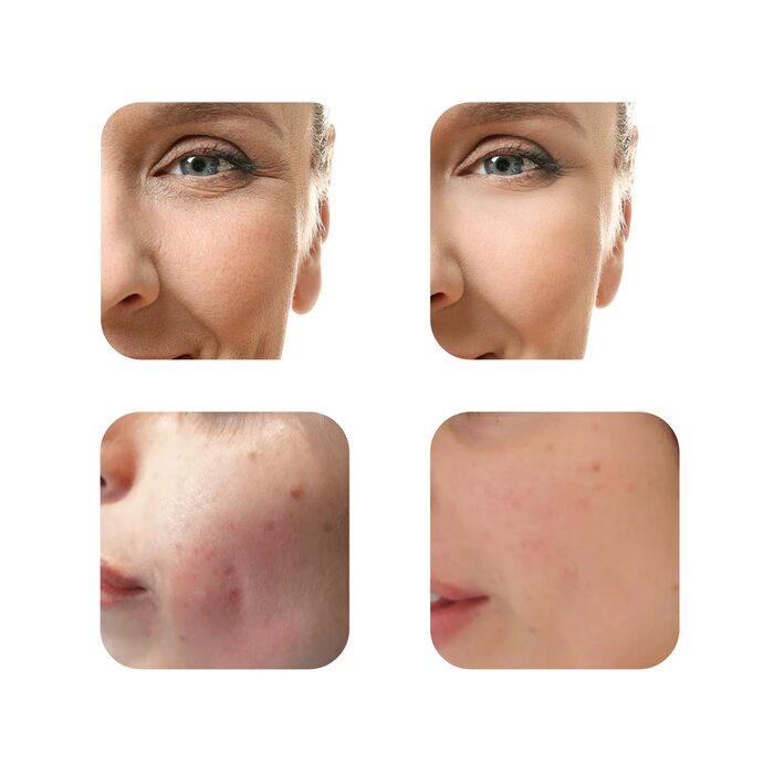 RETINOL 2.5% Serum – Za Glađu Kožu i Ujednačen Ten